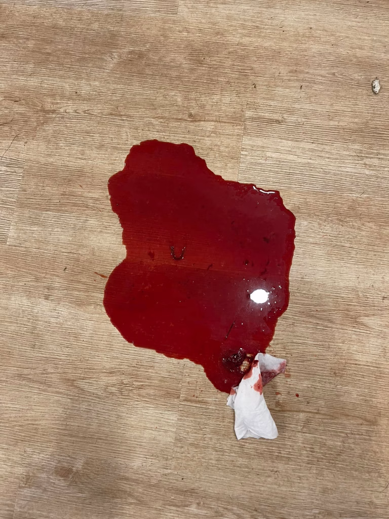 parvoviroza diaree cu sange