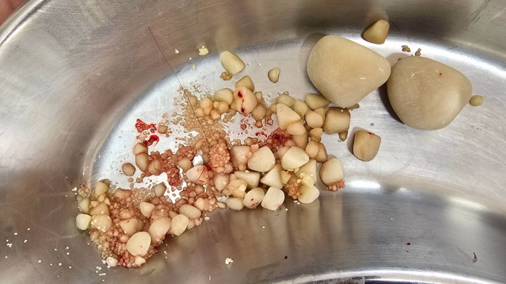 pietre la vezica urinara caini