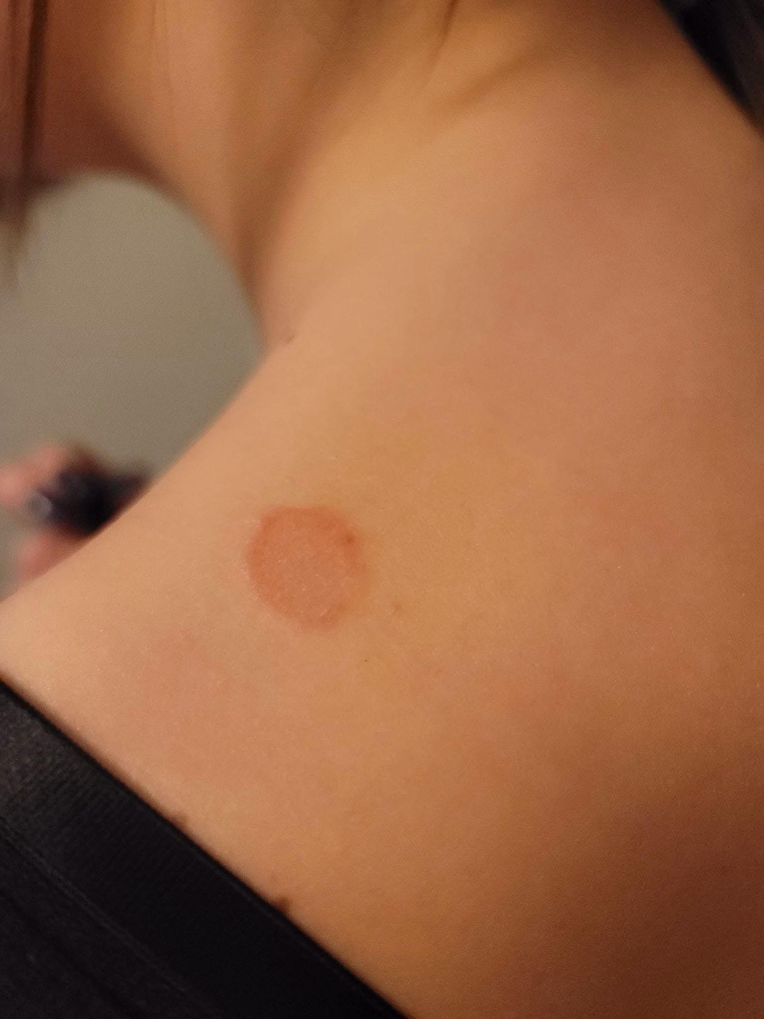 ciuperca de la caine la om