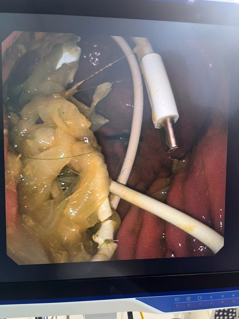 corp strain endoscopie caine